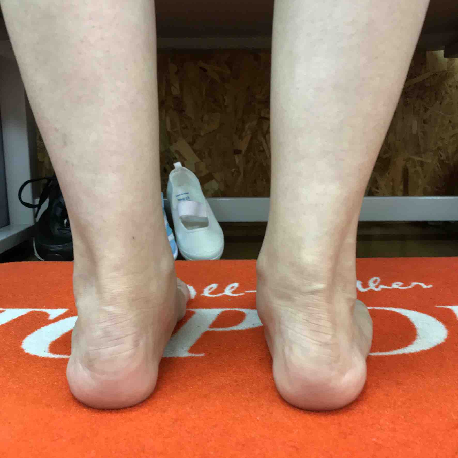 アキレス腱の痛み 足もとから健康を考えるお店 フットルース